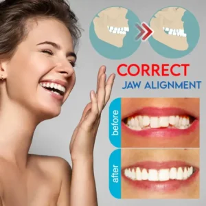 Mandibular Corrector-For a Healthier, More Aligned Smile🦷🔥 - Image 5