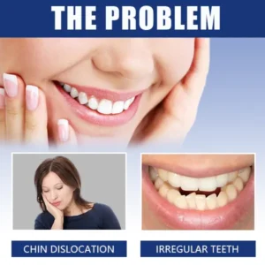 Mandibular Corrector-For a Healthier, More Aligned Smile🦷🔥 - Image 6