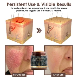 Tallow Bee Venom Skin Restoration Cream - Image 6