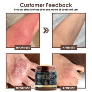 Tallow Bee Venom Skin Restoration Cream - Image 5