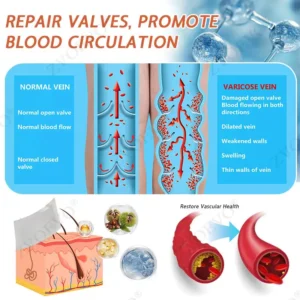 Vein Ease Microneedle Care Patch(For Spider Veins, Varicose Veins, Swelling & Leg Fatigue) - Image 9