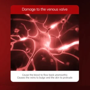 Varicose Veins Relief Cream - Image 5