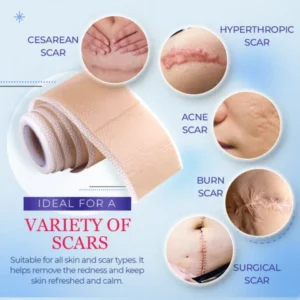 Grade Silicone Scar Sheets