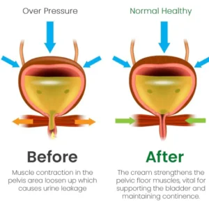 Bladder Control Cream - Image 5