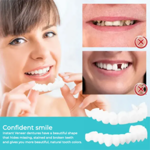 Adjustable Snap-On Dentures - Image 6