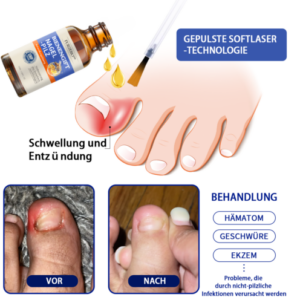 Bee Venom Nail Fungus Treatment Solution - Image 5