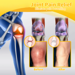 Bee Venom Advanced Joint and Bone Therapy Cream - Image 4