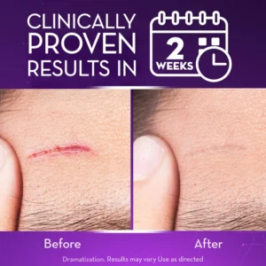 Advanced Scar Gel - Image 5