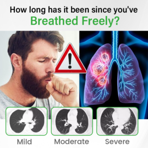 SpireFresh Quercetin Lung Detox Inhaler - Image 8