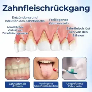 BeeTakt Zahnfleisch-Repair Lösung - Image 9