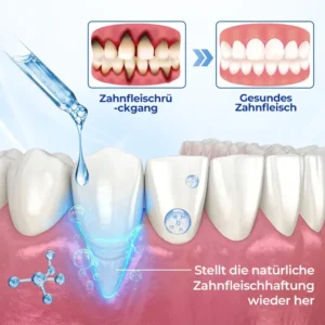 BeeTakt Zahnfleisch-Repair Lösung - Image 8