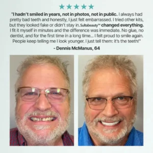 Full Denture - Image 10