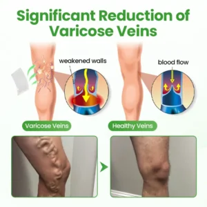VeinHeal Microneedle Patch - Image 3