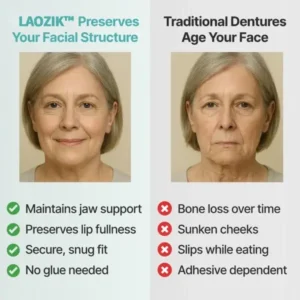 Custom-Fit Functional Dentures - Image 7