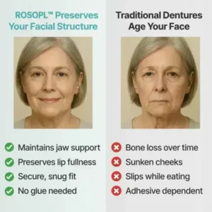 Custom-Fit Functional Dentures - Image 5