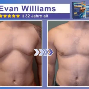 Gynecomastia Breast Fat Burning & Firming Patch - Image 6