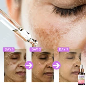 MelantraX Advanced Brightening Essence - Image 5