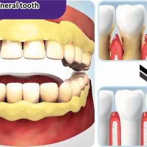 Teeth Restoration Mineral Powder - Image 17