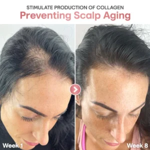 ProRevita Rice Nutri Spray - Image 3