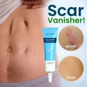 Silicone Scar Gel - Image 4