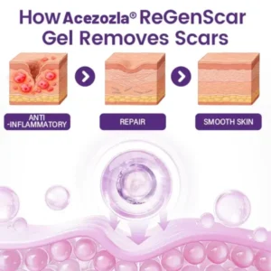 ReGenScar Stem Cell Scar Gel - Image 2