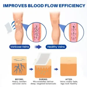 𝑽𝗲𝗶𝙣 𝘾𝐨𝐧𝘁𝗼𝙪𝙧 𝙈𝙞𝐜𝐫𝒐𝒏𝒆𝗲𝗱𝗹𝙚 𝙋𝙖𝐭𝐜𝒉 𝒘𝒊𝘁𝗵 𝗔𝙙𝙫𝙖𝙣𝙘𝐞𝐝 𝐃𝒊𝒐𝒔𝗺𝙞𝐧 & 𝑯𝒆𝘀𝗽𝗲𝙧𝙞𝙙𝙞𝐧 𝐃𝒆𝒍𝒊𝒗𝗲𝗿𝙮🌿𝟕-𝐃𝐚𝐲 𝐕𝐢𝐬𝐢𝐛𝐥𝐞 𝐑𝐞𝐬𝐮𝐥𝐭𝐬 𝐟𝐨𝐫 𝐕𝐚𝐫𝐢𝐜𝐨𝐬𝐞 𝐕𝐞𝐢𝐧𝐬 — 𝗔𝗱𝘃𝗮𝗻𝗰𝗲𝗱 𝗛𝗲𝗿𝗯𝗮𝗹 𝗕𝗹𝗲𝗻𝗱 𝗧𝗮𝗿𝗴𝗲𝘁𝘀 𝗦𝗽𝗶𝗱𝗲𝗿 𝗩𝗲𝗶𝗻𝘀 & 𝗥𝗲𝗹𝗶𝗲𝘃𝗲𝘀 𝗛𝗲𝗮𝘃𝘆, 𝗧𝗶𝗿𝗲𝗱 𝗟𝗲𝗴𝘀 - Image 13