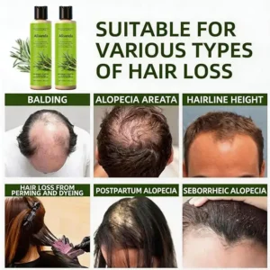 Organic Rosemary Hair Growth Shampoo - Image 2