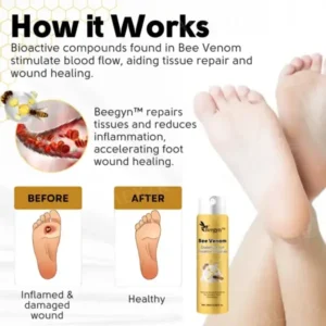 Bee Venom Diabetic Foot Treatment Spray - Image 6