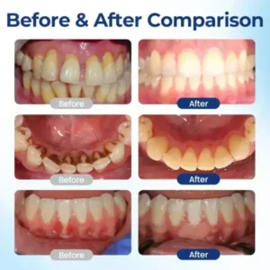 BeeTakt Oral Repair Solution - Image 9