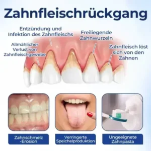 BeeTakt Zahnfleisch-Repair Lösung - Image 8