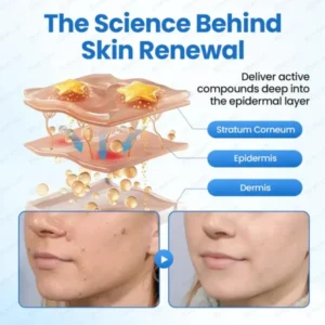 MicroHydro 2-in-1 Microneedle Patch - Image 7