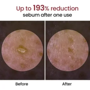 Peel Shot Glow Black Rice Ampoule - Image 6
