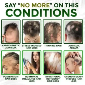 👱‍♂️ Microneedle Herbal Infusion Hair Stimulation Set - Image 4