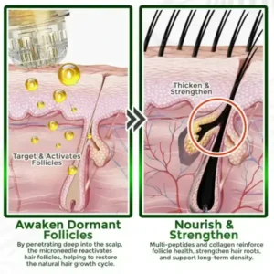 👱‍♂️ Microneedle Herbal Infusion Hair Stimulation Set - Image 6