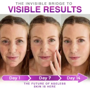 3-in-1 Microneedle Anti-Aging Patch - Image 5