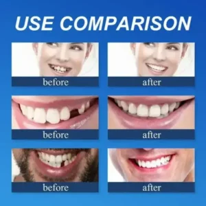 Full Denture with Strong Suctiond Custom-Fit Full Functional Dentures🦷 - Image 5