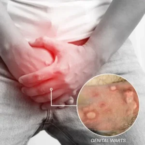 GentX WartRelief Cream - Image 8