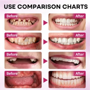 🎄💖Final 3 🦷 YAGOOFirmHold Denture Adhesive — Up to 10 Days of Slip-Free Hold🦷 - Image 2