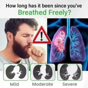 Lung health Detox Inhaler - Image 8
