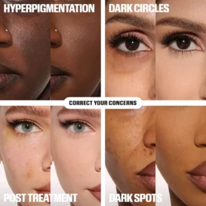 ✨ LAST DAY BUY 1 GET 1 FREE✨Cemenrete Calcium Dark Spot Eye Cream | Dark Circle, Anti-aging, Sagging, Elasticity - Image 9
