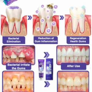Bee Poison Dental Treatment Toothpaste - Image 6