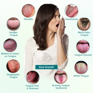 GlosShield Tongue Repair Spray - Image 6