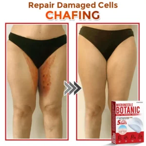 MicroNeedle Botanic Skin Tag Removal Patch - Image 5