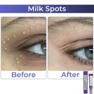 LOVILDS Retinol Intense Advanced Triple Action Eye Cream - Image 13