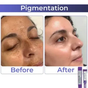LOVILDS Retinol Intense Advanced Triple Action Eye Cream - Image 7