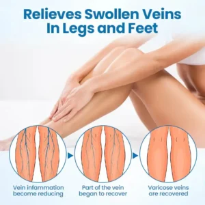 Leg Relief Varicose Veins Cream 50g – Natural Body Care Lotion to Soothe Pain, Reduce Swelling, Improve Circulation & Support Healthy, Comfortable Skin - Image 5