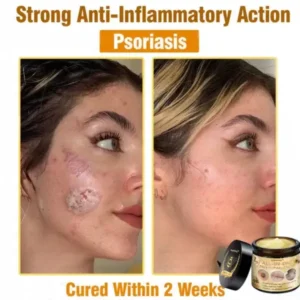 7-Day Rapid Skin Rapair Cream US Dermatologist Approved - Image 3