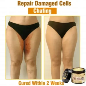7-Day Rapid Skin Rapair Cream US Dermatologist Approved - Image 5