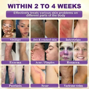 Alternative view of Made and Shipped from Biotin 10-in-1 Skin Restoration Cream - Last Day Promotion: 75% OFF