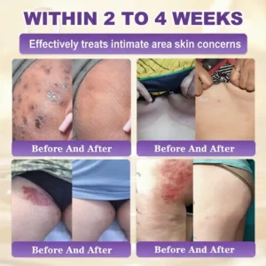 Made and Shipped from Biotin 10-in-1 Skin Restoration Cream - Last Day Promotion: 75% OFF - Image 4
